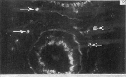 https://cdn.ncbi.nlm.nih.gov/pmc/blobs/fcb0/1233089/34ed156c67f1/janat00237-0151-a.jpg