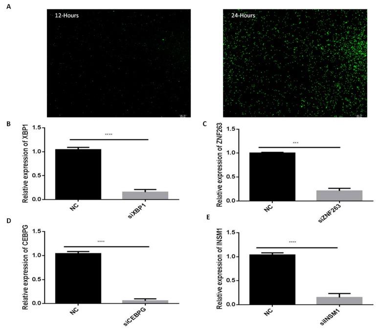 https://cdn.ncbi.nlm.nih.gov/pmc/blobs/fcb0/6769628/af026b87bb69/ijms-20-04338-g007.jpg