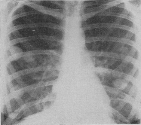 https://cdn.ncbi.nlm.nih.gov/pmc/blobs/fcb2/1831226/52ea20820c65/canmedaj00813-0045-b.jpg