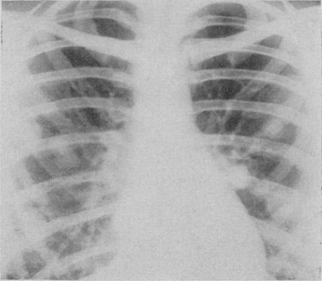 https://cdn.ncbi.nlm.nih.gov/pmc/blobs/fcb2/1831226/5f62501ca59f/canmedaj00813-0044-b.jpg