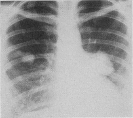 https://cdn.ncbi.nlm.nih.gov/pmc/blobs/fcb2/1831226/a1ec3980501f/canmedaj00813-0046-a.jpg