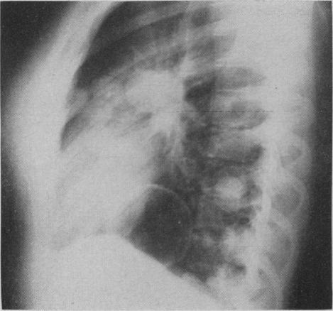 https://cdn.ncbi.nlm.nih.gov/pmc/blobs/fcb2/1831226/c5e54dd7e95e/canmedaj00813-0045-a.jpg
