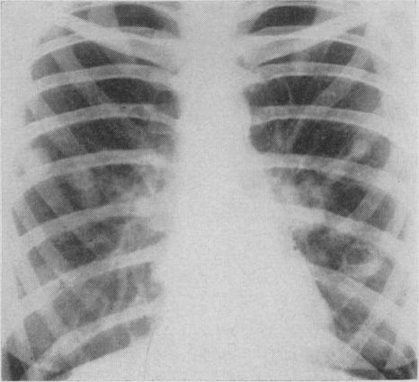 https://cdn.ncbi.nlm.nih.gov/pmc/blobs/fcb2/1831226/ccae1425ed8e/canmedaj00813-0044-a.jpg