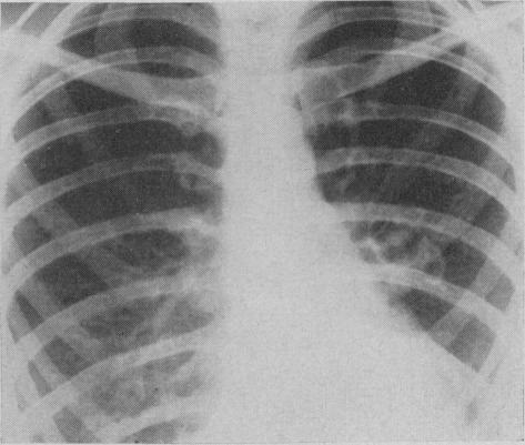 https://cdn.ncbi.nlm.nih.gov/pmc/blobs/fcb2/1831226/ed20d3de0f8b/canmedaj00813-0045-c.jpg