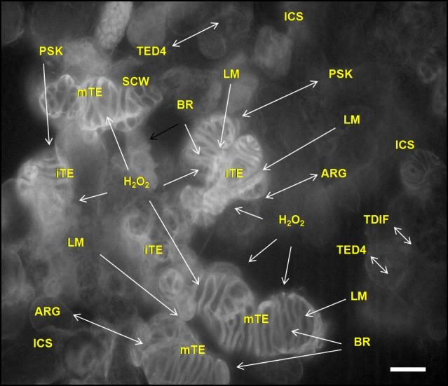 https://cdn.ncbi.nlm.nih.gov/pmc/blobs/fcb6/5357506/62d6f1a1257f/425_2017_2656_Fig4_HTML.jpg