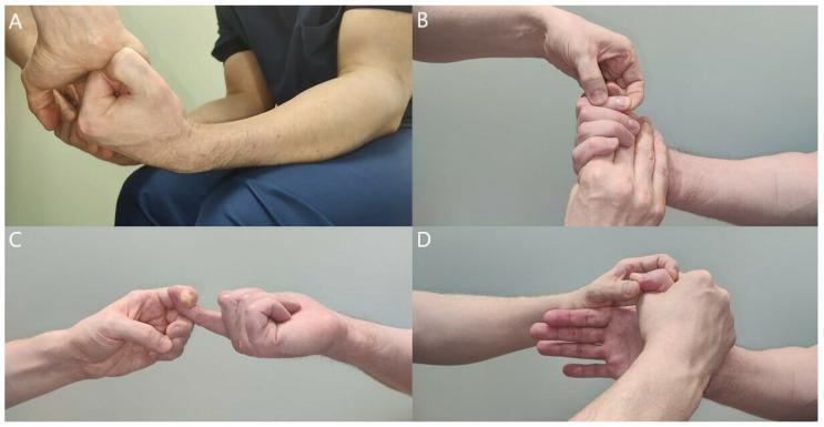 https://cdn.ncbi.nlm.nih.gov/pmc/blobs/fcb7/9317082/1a1bb8911989/jcm-11-03988-g006.jpg