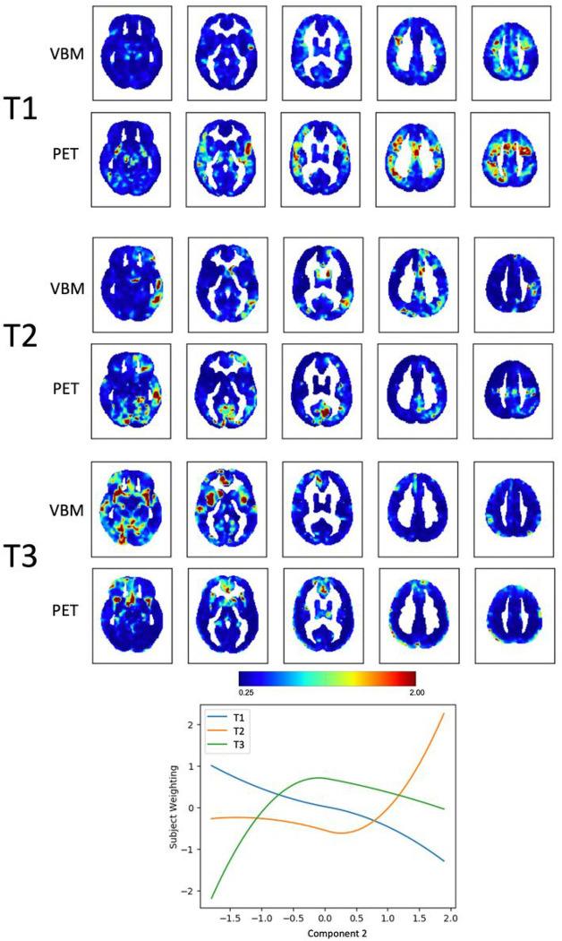 https://cdn.ncbi.nlm.nih.gov/pmc/blobs/fcba/10479452/743d7b49e191/nihpp-rs3271530v1-f0003.jpg