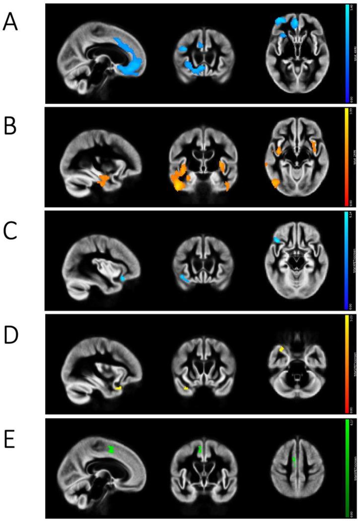 https://cdn.ncbi.nlm.nih.gov/pmc/blobs/fcba/10479452/b92f3b6e7146/nihpp-rs3271530v1-f0001.jpg