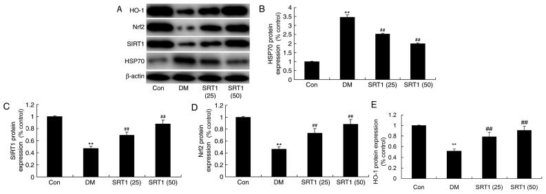 https://cdn.ncbi.nlm.nih.gov/pmc/blobs/fcbd/6323206/6e2fb0894561/MMR-19-02-1040-g06.jpg
