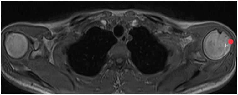 https://cdn.ncbi.nlm.nih.gov/pmc/blobs/fcbe/10795676/b3d5416a89bf/diagnostics-14-00107-g004.jpg