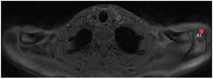 https://cdn.ncbi.nlm.nih.gov/pmc/blobs/fcbe/10795676/ec4de8bdcf03/diagnostics-14-00107-g007.jpg