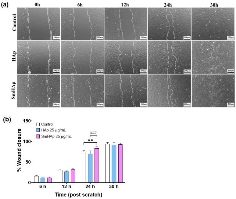 https://cdn.ncbi.nlm.nih.gov/pmc/blobs/fcc3/11201808/c931fdebbf5b/biomimetics-09-00309-g014.jpg