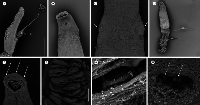 https://cdn.ncbi.nlm.nih.gov/pmc/blobs/fcc3/12291546/ff0862947585/parasite-32-44-fig4.jpg