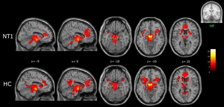 https://cdn.ncbi.nlm.nih.gov/pmc/blobs/fcc8/8278207/84a34d1ea56a/gr1.jpg
