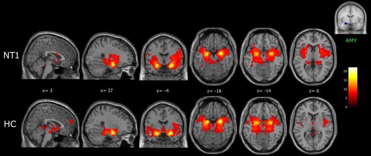 https://cdn.ncbi.nlm.nih.gov/pmc/blobs/fcc8/8278207/bd05cb240719/gr3.jpg