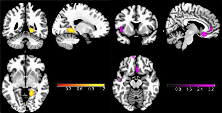 https://cdn.ncbi.nlm.nih.gov/pmc/blobs/fcca/12022757/85b1eadeeb33/fpsyt-16-1403604-g002.jpg