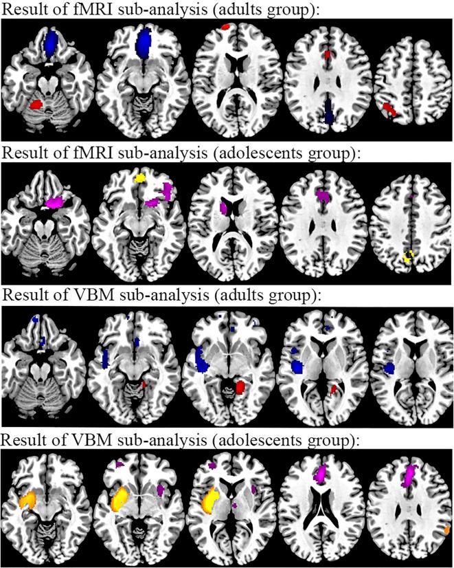https://cdn.ncbi.nlm.nih.gov/pmc/blobs/fcca/12022757/ec1ba0b3d80e/fpsyt-16-1403604-g006.jpg