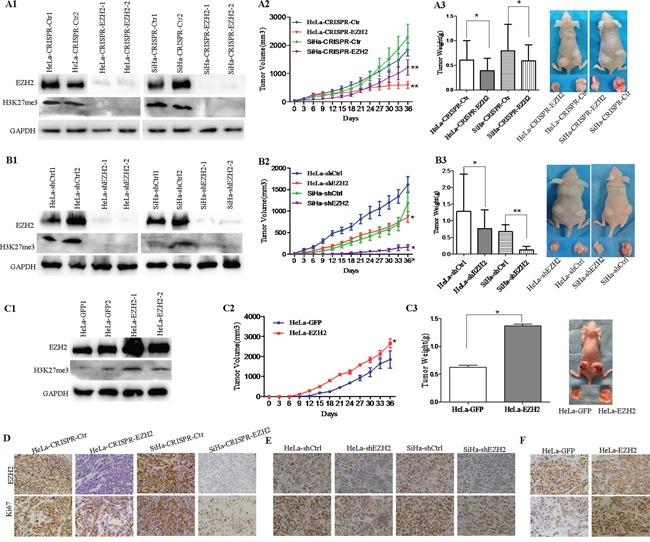 https://cdn.ncbi.nlm.nih.gov/pmc/blobs/fccc/5094987/4f1a853351b9/oncotarget-07-36115-g002.jpg
