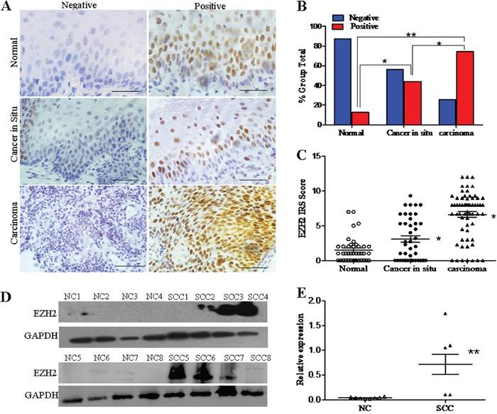 https://cdn.ncbi.nlm.nih.gov/pmc/blobs/fccc/5094987/717e4ab53c61/oncotarget-07-36115-g001.jpg