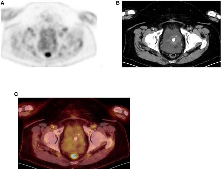 https://cdn.ncbi.nlm.nih.gov/pmc/blobs/fccd/11440875/057eaa918baa/fnume-01-826109-g0014.jpg