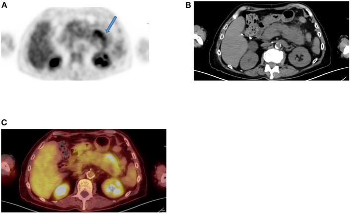 https://cdn.ncbi.nlm.nih.gov/pmc/blobs/fccd/11440875/5baf8da6e2eb/fnume-01-826109-g0010.jpg