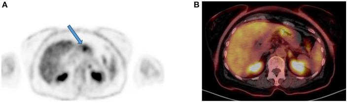 https://cdn.ncbi.nlm.nih.gov/pmc/blobs/fccd/11440875/613951c01234/fnume-01-826109-g0009.jpg