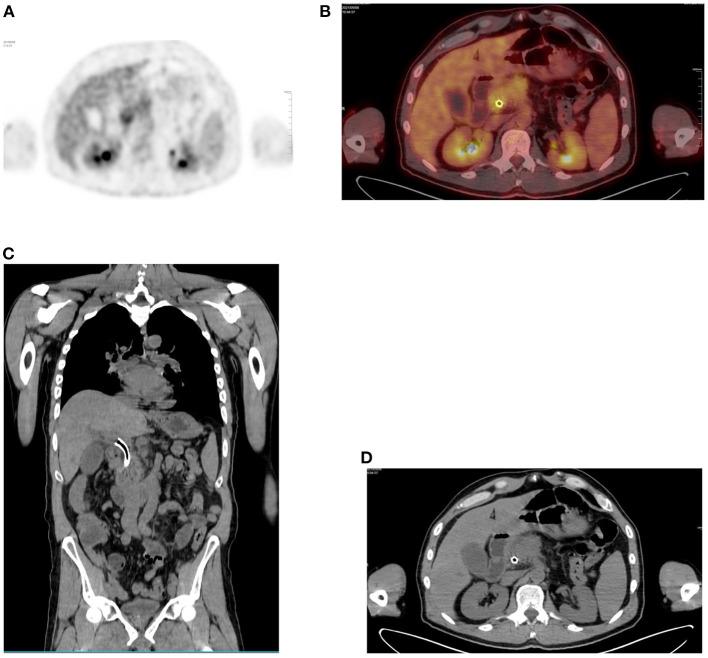 https://cdn.ncbi.nlm.nih.gov/pmc/blobs/fccd/11440875/858e9df35366/fnume-01-826109-g0007.jpg