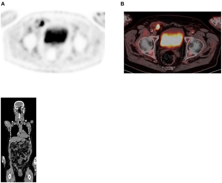 https://cdn.ncbi.nlm.nih.gov/pmc/blobs/fccd/11440875/a94b8be4577b/fnume-01-826109-g0017.jpg