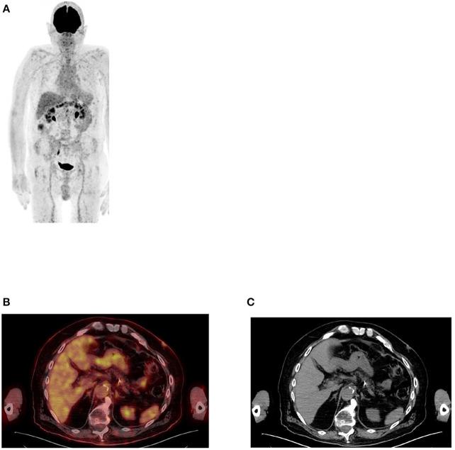 https://cdn.ncbi.nlm.nih.gov/pmc/blobs/fccd/11440875/e96eac16b651/fnume-01-826109-g0002.jpg