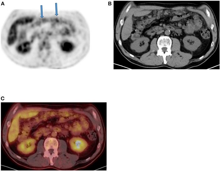 https://cdn.ncbi.nlm.nih.gov/pmc/blobs/fccd/11440875/ed19f460ef55/fnume-01-826109-g0012.jpg