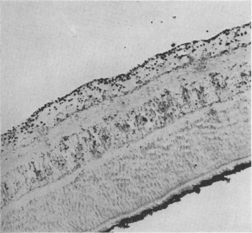 https://cdn.ncbi.nlm.nih.gov/pmc/blobs/fcd4/1323847/ad3080c98dbd/brjopthal01172-0040-a.jpg