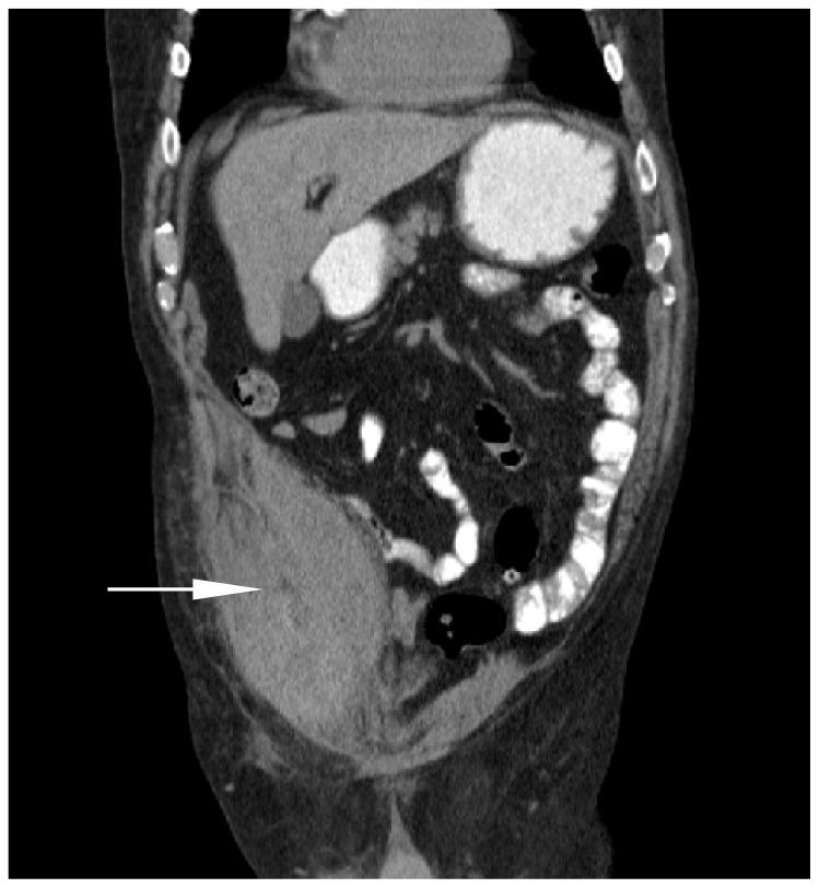 https://cdn.ncbi.nlm.nih.gov/pmc/blobs/fcda/4427215/41653f77ddc9/wjem-16-420-g002.jpg