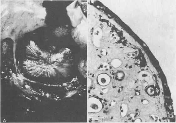 https://cdn.ncbi.nlm.nih.gov/pmc/blobs/fcdc/1272067/d52c46881dda/westjmed00236-0039-a.jpg