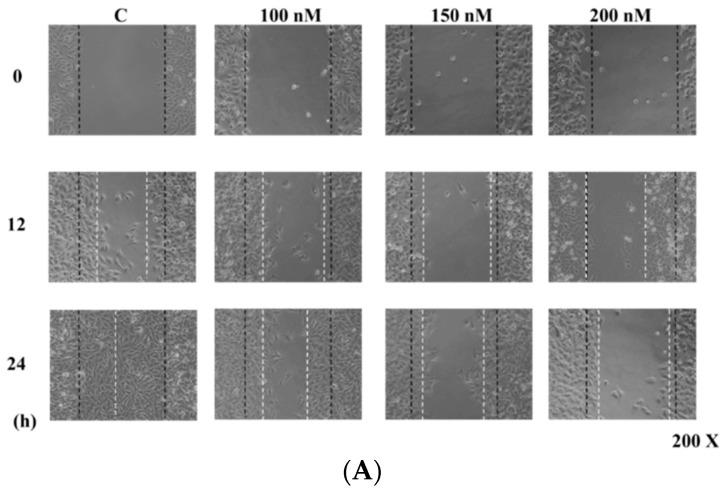 https://cdn.ncbi.nlm.nih.gov/pmc/blobs/fce1/6274196/bc373c058785/molecules-21-00384-g002a.jpg