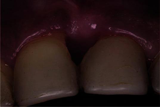 https://cdn.ncbi.nlm.nih.gov/pmc/blobs/fcec/11217061/d1425e02a4a6/JDS-25-183-g013.jpg
