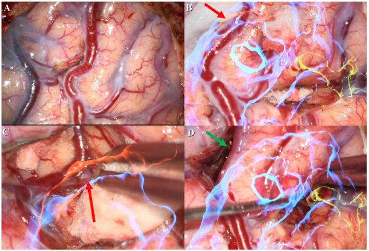 https://cdn.ncbi.nlm.nih.gov/pmc/blobs/fcef/10136434/0f16e08639c6/brainsci-13-00653-g002.jpg