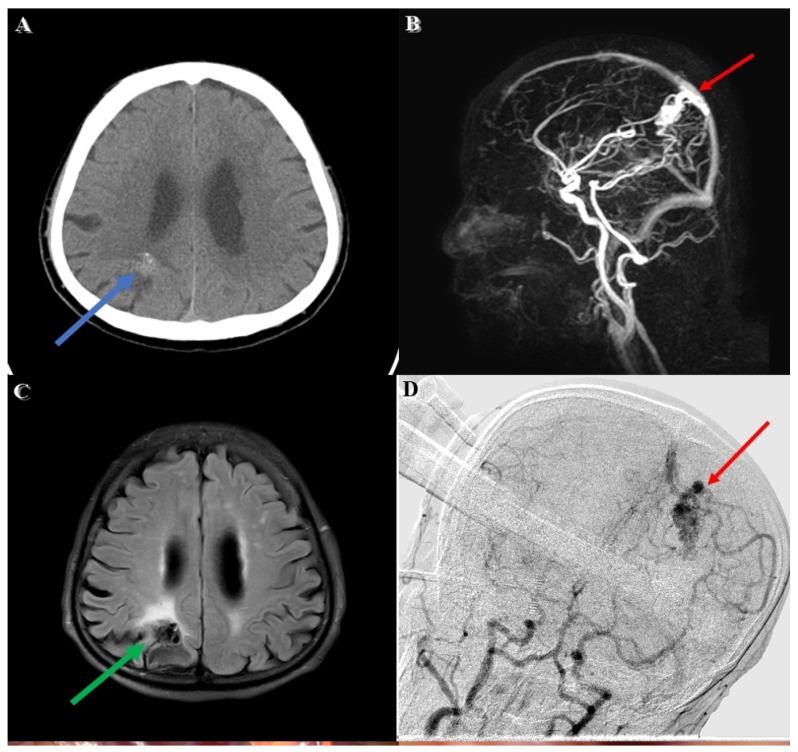 https://cdn.ncbi.nlm.nih.gov/pmc/blobs/fcef/10136434/9e52ed4d38f1/brainsci-13-00653-g001.jpg
