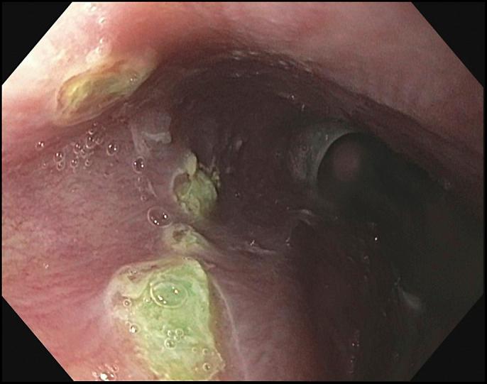 https://cdn.ncbi.nlm.nih.gov/pmc/blobs/fcf5/8483873/e10b2efcfcad/ac9-7-e00479-g004.jpg