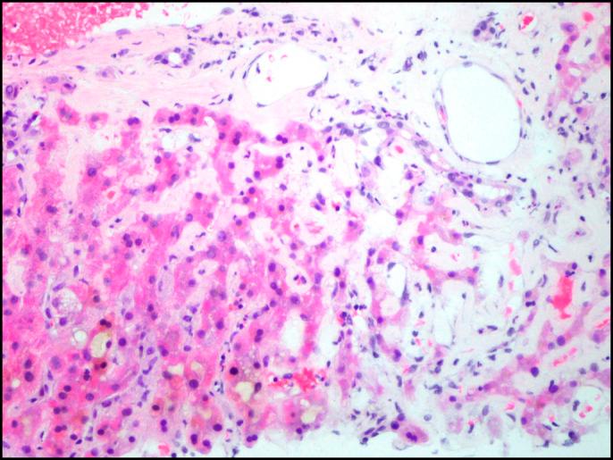 https://cdn.ncbi.nlm.nih.gov/pmc/blobs/fcf5/8483873/f8a862c64432/ac9-7-e00479-g002.jpg
