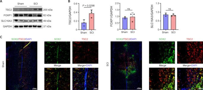https://cdn.ncbi.nlm.nih.gov/pmc/blobs/fd26/11881710/336b0484c7fa/NRR-20-3273-g005.jpg