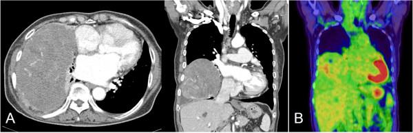 https://cdn.ncbi.nlm.nih.gov/pmc/blobs/fd26/4078939/633eb7d33465/1749-8090-9-113-1.jpg