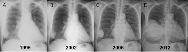 https://cdn.ncbi.nlm.nih.gov/pmc/blobs/fd26/4078939/e96f07c1aa2e/1749-8090-9-113-2.jpg