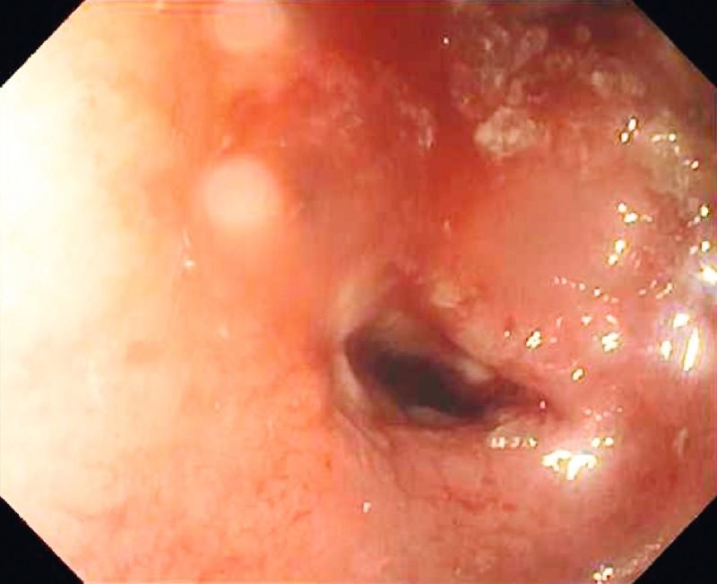https://cdn.ncbi.nlm.nih.gov/pmc/blobs/fd26/4423295/9f4cebc44477/10-1055-s-0034-1377522-i074ei3.jpg