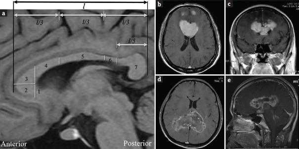 https://cdn.ncbi.nlm.nih.gov/pmc/blobs/fd28/5602263/c9bafb215907/JNRP-8-57-g001.jpg