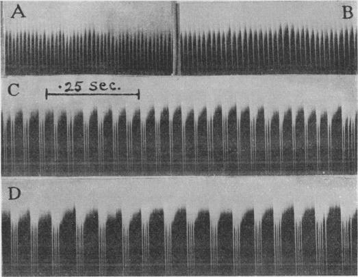 https://cdn.ncbi.nlm.nih.gov/pmc/blobs/fd2d/1394851/48fe0c32677b/jphysiol01623-0146-b.jpg
