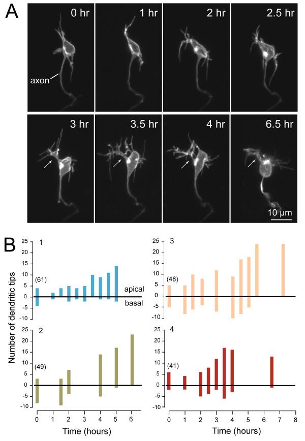https://cdn.ncbi.nlm.nih.gov/pmc/blobs/fd31/2988773/a61284d59e86/1749-8104-5-29-2.jpg