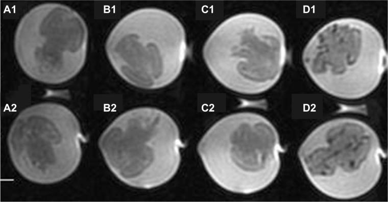 https://cdn.ncbi.nlm.nih.gov/pmc/blobs/fd37/3814992/765405b430b4/ijn-8-4063Fig8.jpg