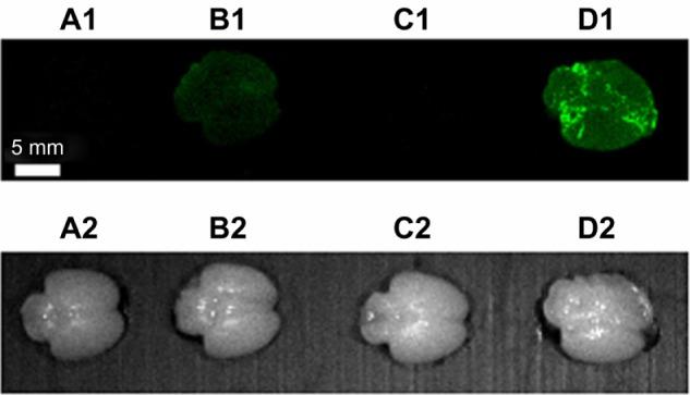 https://cdn.ncbi.nlm.nih.gov/pmc/blobs/fd37/3814992/8892a927d50c/ijn-8-4063Fig10.jpg