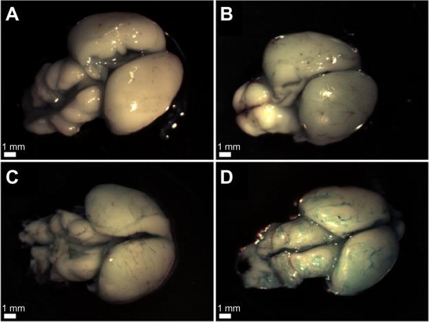 https://cdn.ncbi.nlm.nih.gov/pmc/blobs/fd37/3814992/bcc0bc171fa8/ijn-8-4063Fig9.jpg