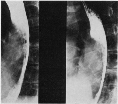 https://cdn.ncbi.nlm.nih.gov/pmc/blobs/fd37/471408/1ea71988d282/thorax00180-0011-a.jpg